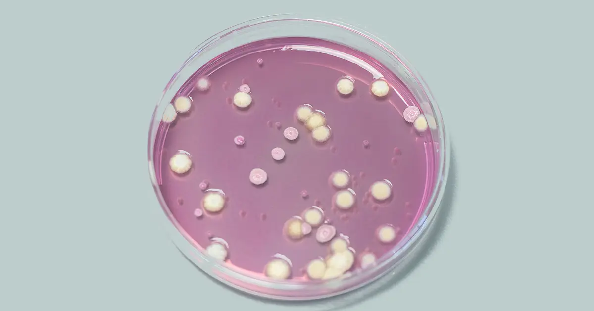 symphony-agar